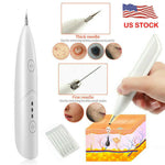 Ion Laser Freckle Skin Mole Dark Spot Remover Face Wart Tag Tattoo Removal Pen - SuperGlim